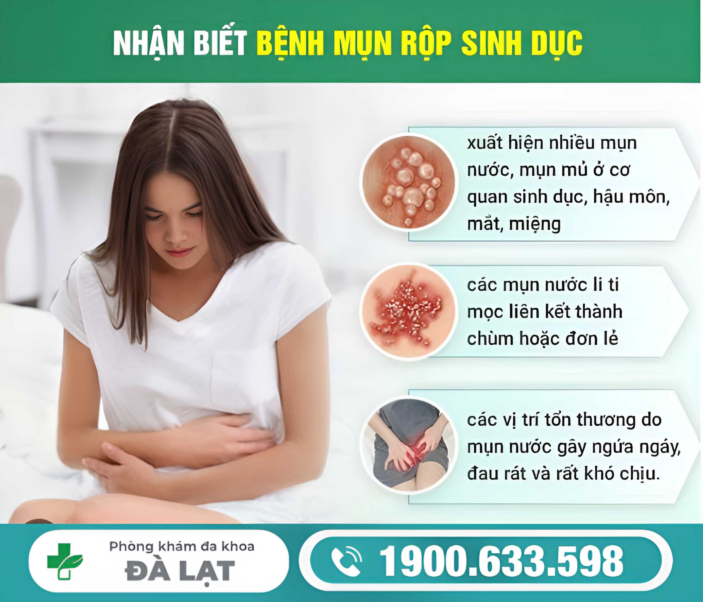 Hình ảnh minh họa